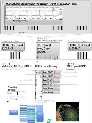 Monophasic-quadri-burst stimulation robustly activates bilateral swallowing motor cortices